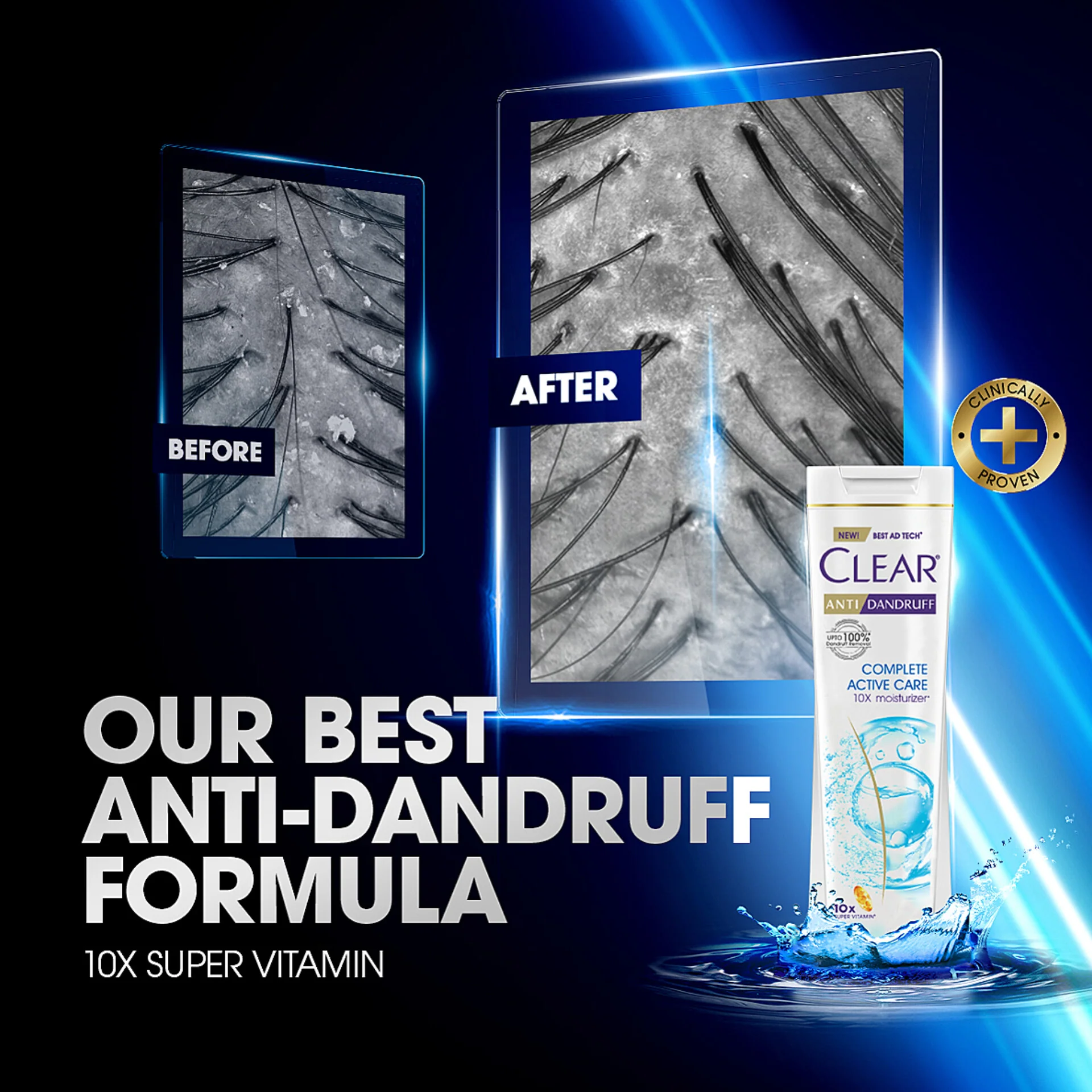 Clear Shampoo Complete Active Care Anti Dandruff 170ml - Image 4